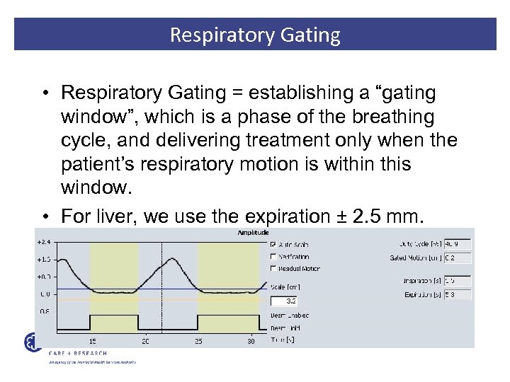 Respiratory Gating • Respiratory Gating = establishing a “gating window”, which is a phase
