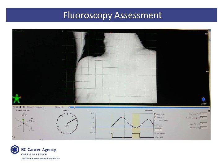 Fluoroscopy Assessment 