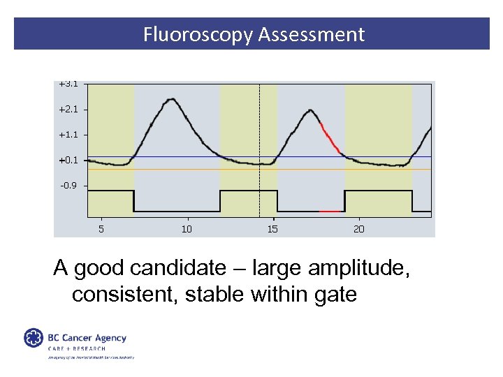 Fluoroscopy Assessment A good candidate – large amplitude, consistent, stable within gate 