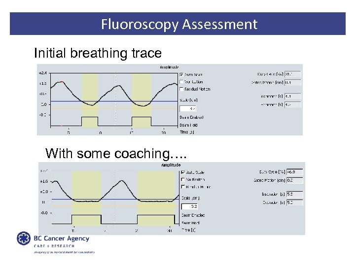 Fluoroscopy Assessment Initial breathing trace With some coaching…. 