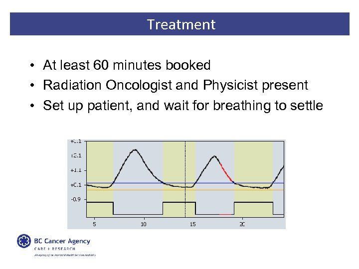 Treatment • At least 60 minutes booked • Radiation Oncologist and Physicist present •