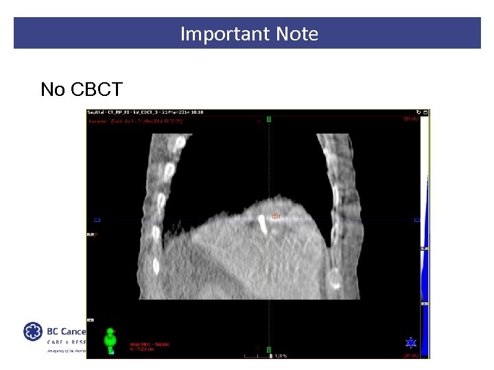 Important Note No CBCT 