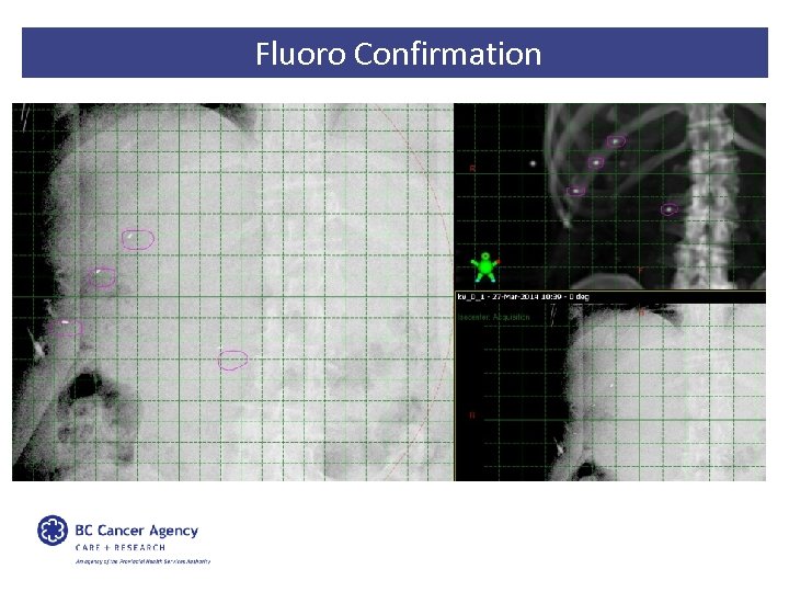 Fluoro Confirmation 