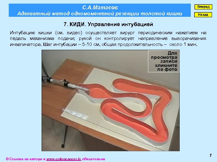 С. А. Матасов Адекватный метод одномоментной резекции толстой кишки 7. КИДИ. Управление интубацией Интубацию