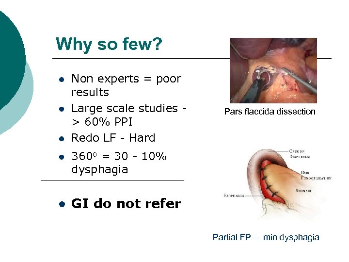 Why so few? Non experts = poor results Large scale studies > 60% PPI