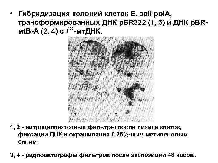  • Гибридизация колоний клеток E. coli pol. A, трансформированных ДНК p. BR 322