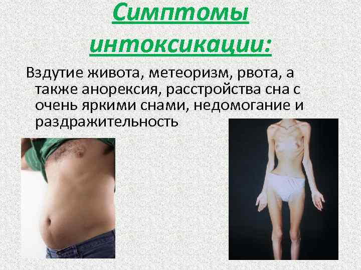 Симптомы интоксикации: Вздутие живота, метеоризм, рвота, а также анорексия, расстройства сна с очень яркими