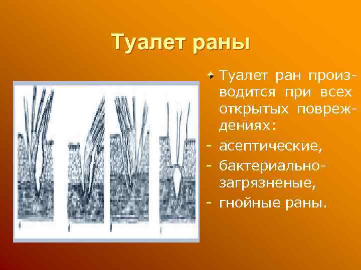 Туалет раны Туалет ран производится при всех открытых повреждениях: - асептические, - бактериальнозагрязненые, -