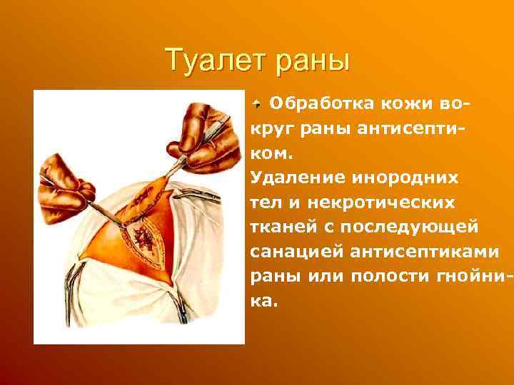 Туалет раны Обработка кожи вокруг раны антисептиком. Удаление инородних тел и некротических тканей с