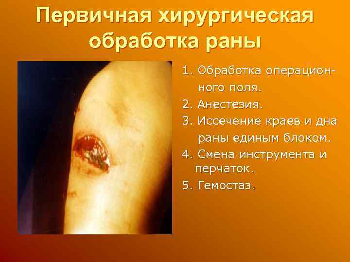 Первичная хирургическая обработка раны 1. Обработка операционного поля. 2. Анестезия. 3. Иссечение краев и