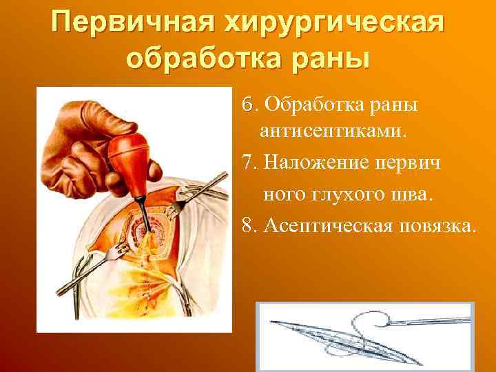 Первичная хирургическая обработка раны 6. Обработка раны антисептиками. 7. Наложение первич ного глухого шва.