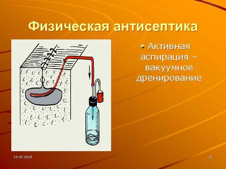 Физическая антисептика Активная аспирация – вакуумное дренирование 16. 02. 2018 21 