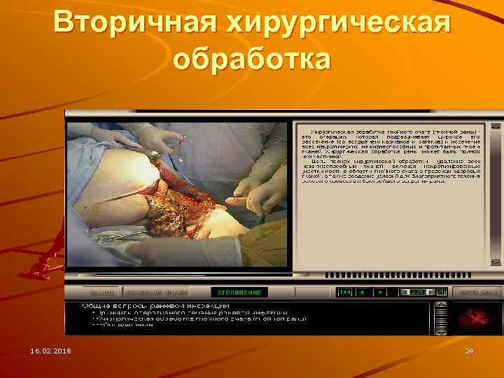 Вторичная хирургическая обработка 16. 02. 2018 24 