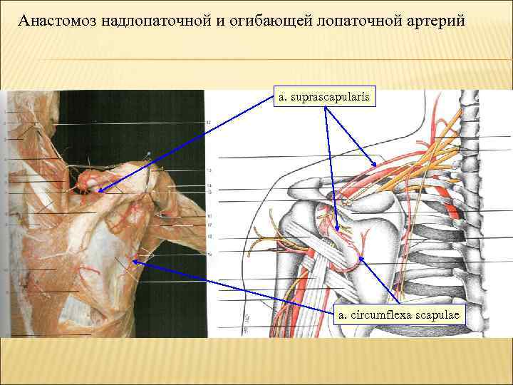 Анастомоз надлопаточной и огибающей лопаточной артерий a. suprascapularis a. circumflexa scapulae 