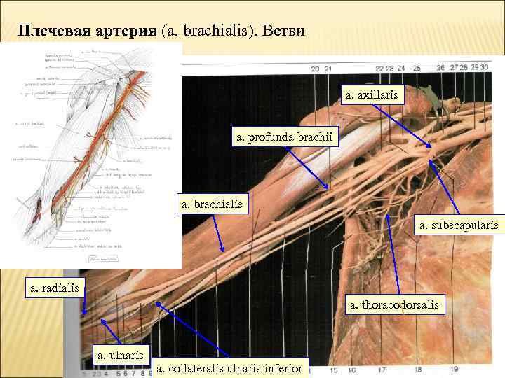 Плечевая артерия (a. brachialis). Ветви a. axillaris a. profunda brachii a. brachialis a. subscapularis
