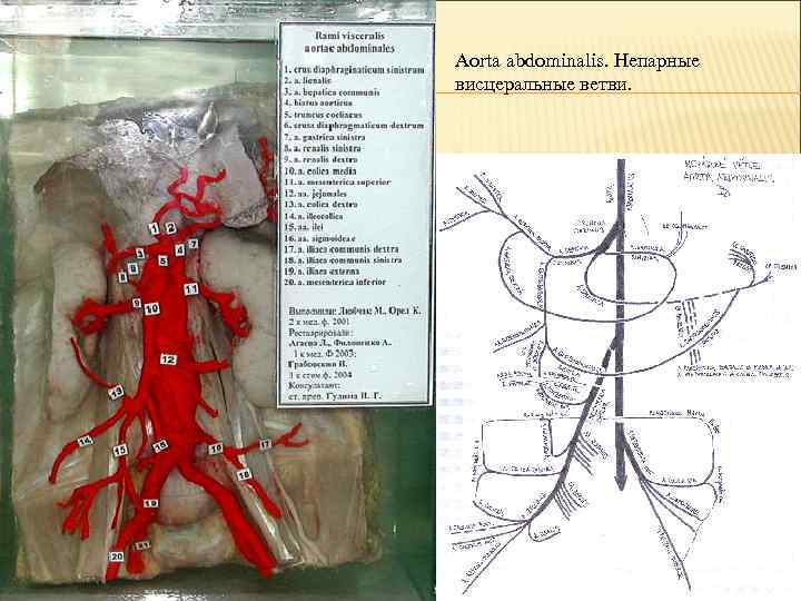 Aorta abdominalis. Непарные висцеральные ветви. 