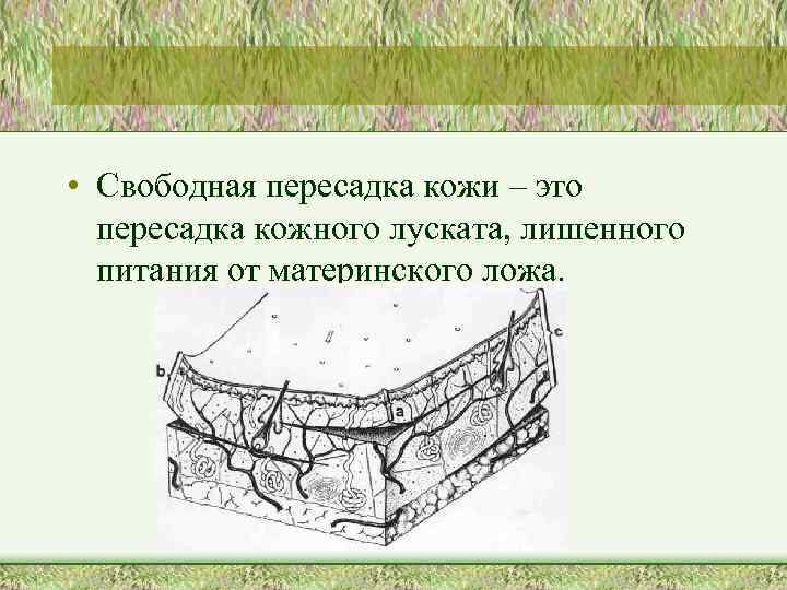  • Свободная пересадка кожи – это пересадка кожного луската, лишенного питания от материнского