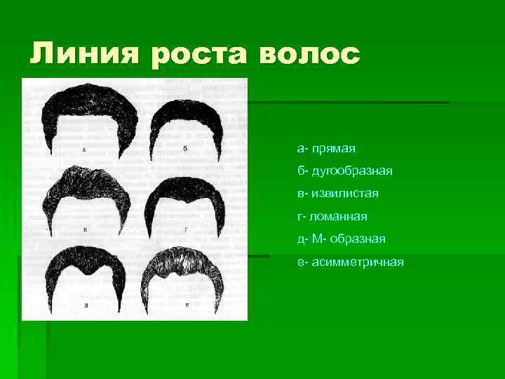 Линия роста волос а- прямая б- дугообразная в- извилистая г- ломанная д- М- образная