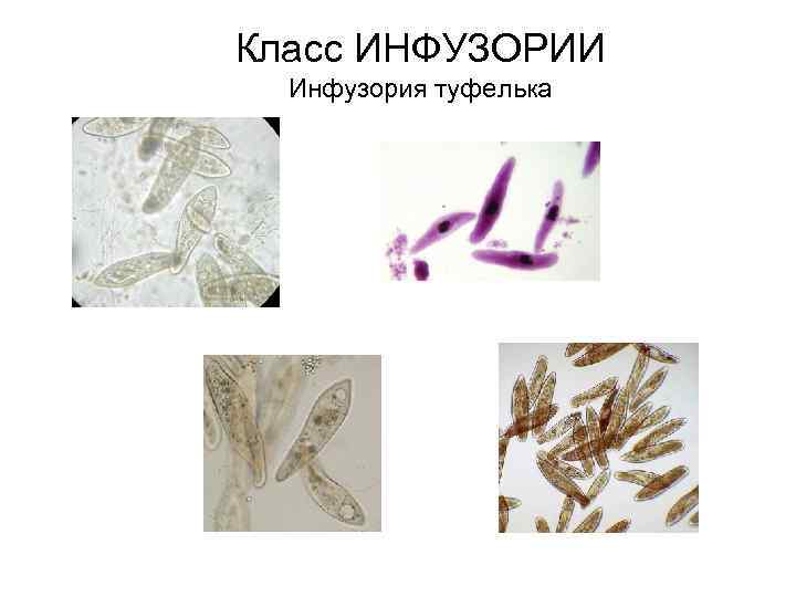 Класс ИНФУЗОРИИ Инфузория туфелька 