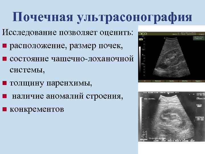 Почечная ультрасонография Исследование позволяет оценить: n расположение, размер почек, n состояние чашечно-лоханочной системы, n