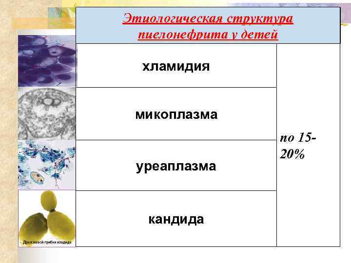 Этиологическая структура пиелонефрита у детей хламидия микоплазма уреаплазма кандида по 1520% 