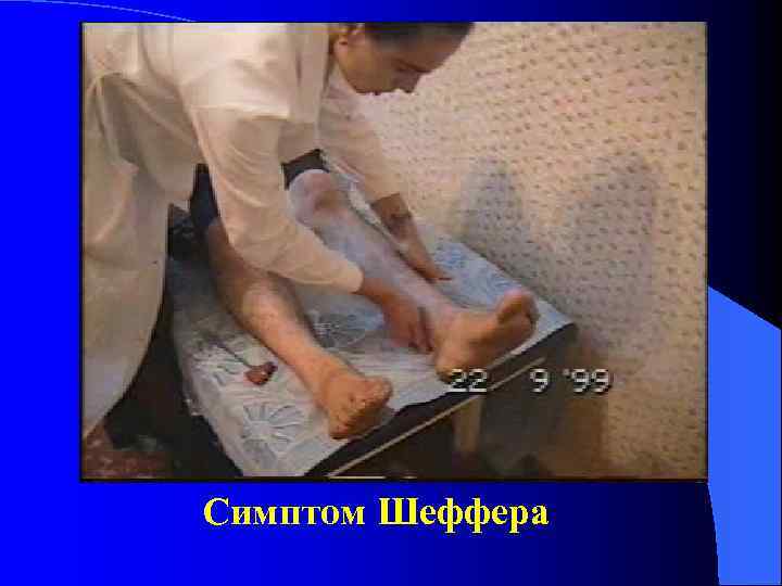 Симптом Шеффера 