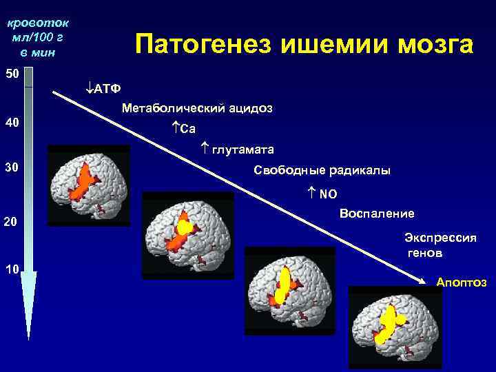 Ишемия мозга степени