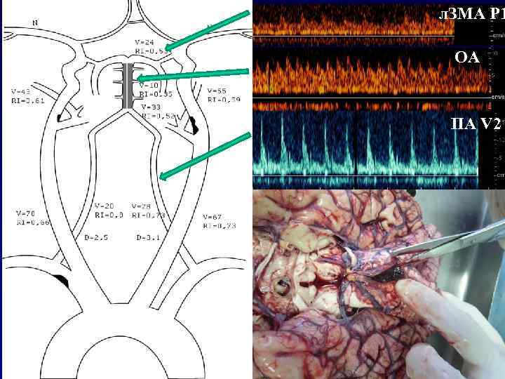 л. ЗМА Р 1 ОА ПА V 2 