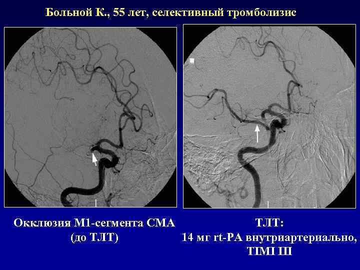 Сегменты сма на кт схема