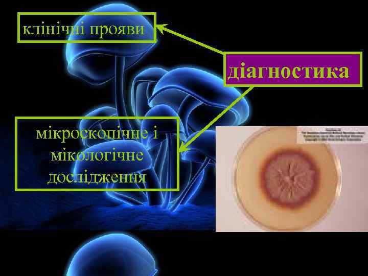 клінічні прояви діагностика мікроскопічне і мікологічне дослідження 