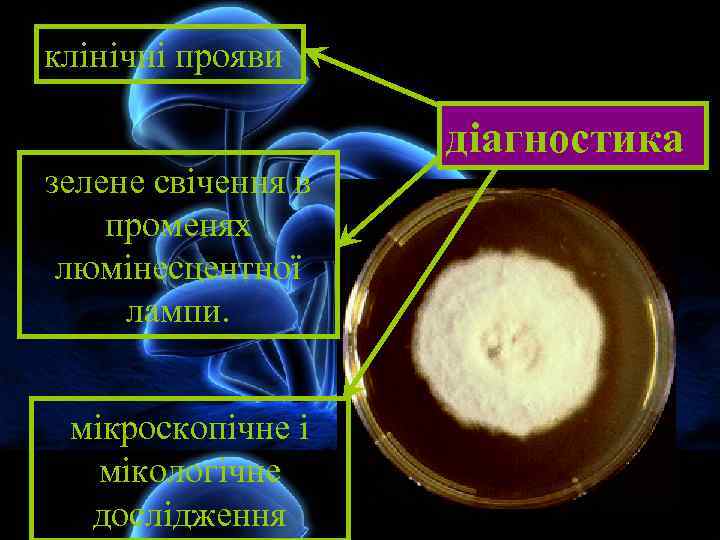 клінічні прояви зелене свічення в променях люмінесцентної лампи. мікроскопічне і мікологічне дослідження діагностика 