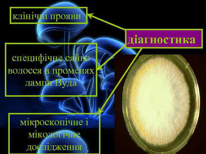 клінічні прояви діагностика специфічне сяйво волосся в променях лампи Вуда мікроскопічне і мікологічне дослідження