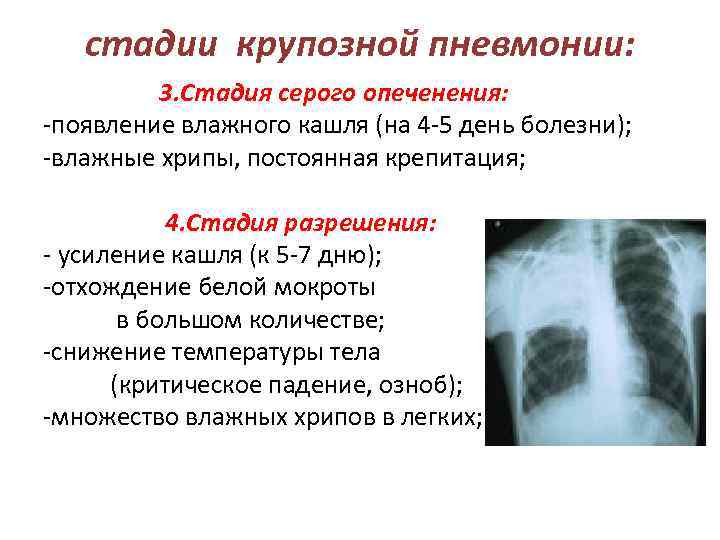 стадии крупозной пневмонии: 3. Стадия серого опеченения: -появление влажного кашля (на 4 -5 день