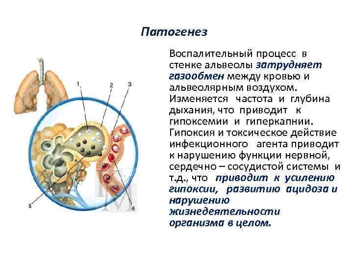 Патогенез Воспалительный процесс в стенке альвеолы затрудняет газообмен между кровью и альвеолярным воздухом. Изменяется