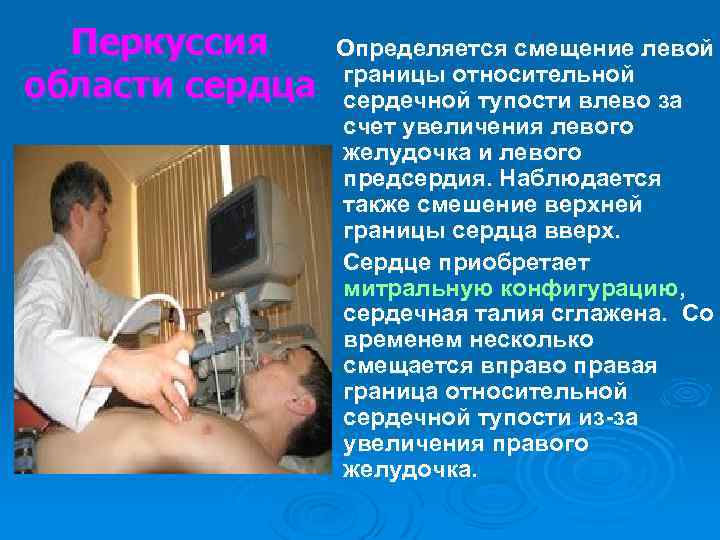 Перкуссия области сердца Определяется смещение левой границы относительной сердечной тупости влево за счет увеличения