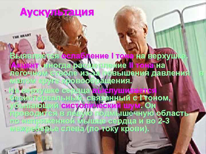 Аускультация Выявляется ослабление I тона на верхушке. Акцент, иногда расщепление II тона на легочном