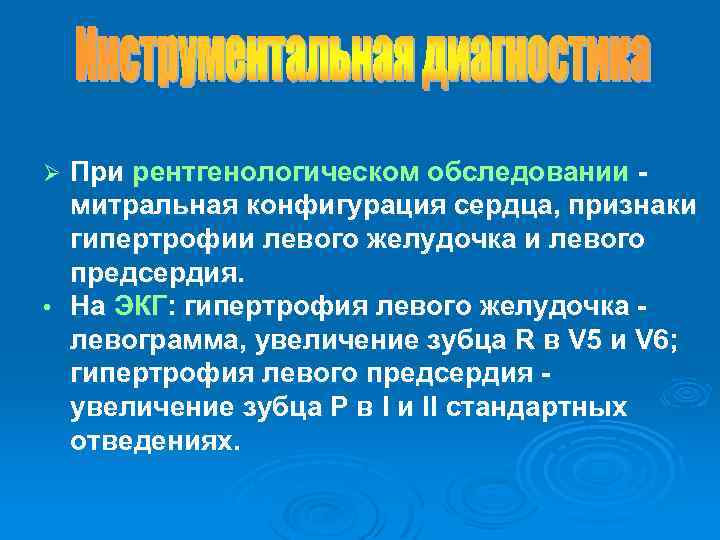 При рентгенологическом обследовании митральная конфигурация сердца, признаки гипертрофии левого желудочка и левого предсердия. •