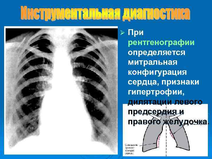 Нормальная конфигурация сердца рисунок