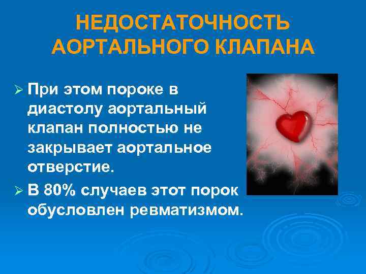 НЕДОСТАТОЧНОСТЬ АОРТАЛЬНОГО КЛАПАНА Ø При этом пороке в диастолу аортальный клапан полностью не закрывает