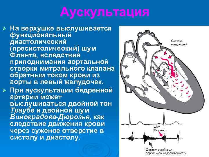 Шум остина флинта выслушивается в точке обозначенной на рисунке цифрой