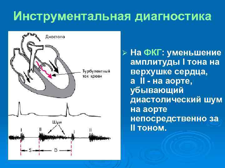 Уменьшение амплитуды. ФКГ диастолический шум. Уменьшение амплитуды i тона на ФКГ. Снижение амплитуды на ФКГ. ФКГ это в медицине.