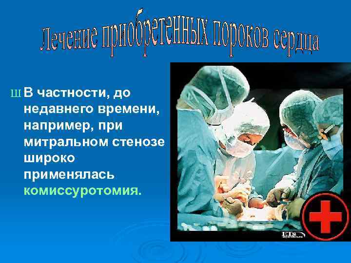 Ш В частности, до недавнего времени, например, при митральном стенозе широко применялась комиссуротомия. 
