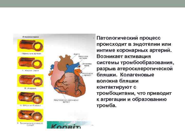  • Патологический процесс происходит в эндотелии или интиме коронарных артерий. Возникает активация системы
