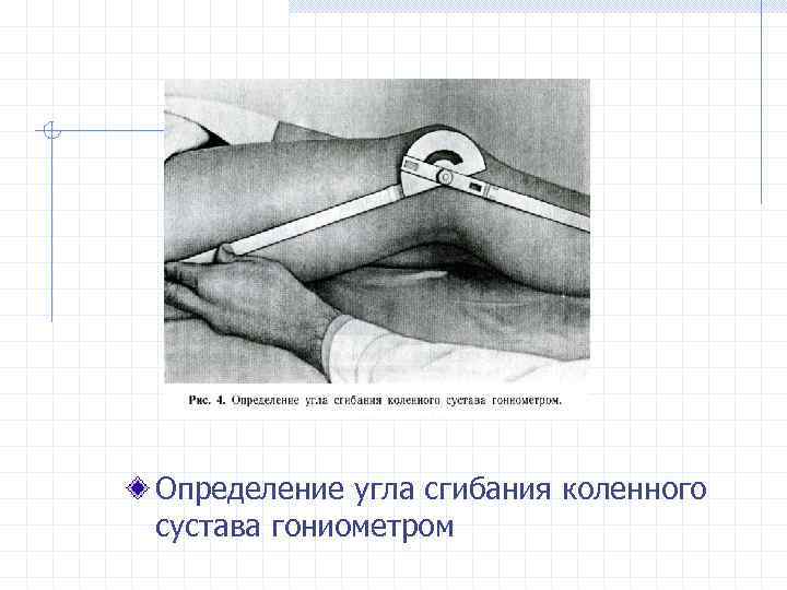 Определение угла сгибания коленного сустава гониометром 