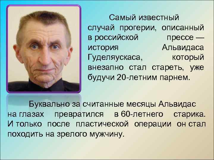 Самый известный случай прогерии, описанный в российской прессе — история Альвидаса Гуделяускаса, который внезапно