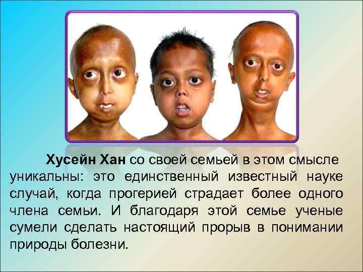 Хусейн Хан со своей семьей в этом смысле уникальны: это единственный известный науке случай,