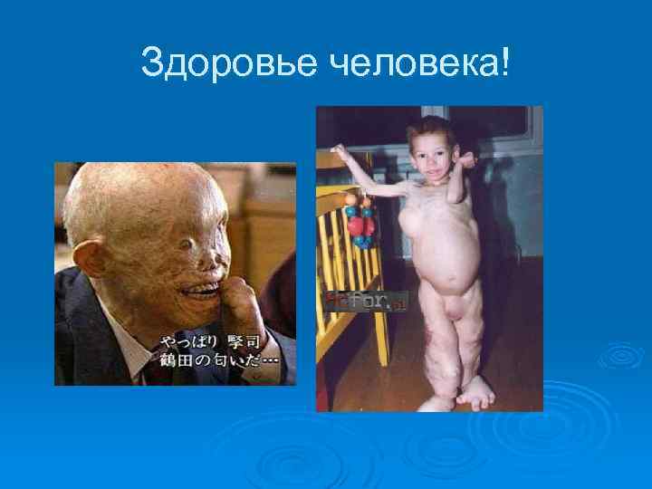 Здоровье человека! 