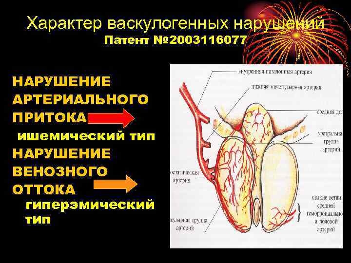 Характер васкулогенных нарушений Патент № 2003116077 НАРУШЕНИЕ АРТЕРИАЛЬНОГО ПРИТОКА ишемический тип НАРУШЕНИЕ ВЕНОЗНОГО ОТТОКА