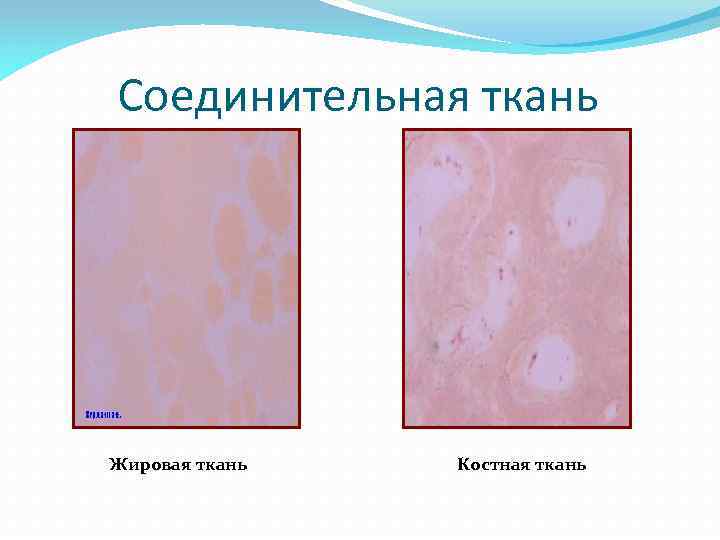 Соединительная ткань Жировая ткань Костная ткань 