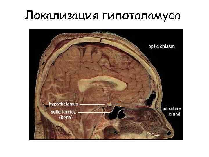 Локализация гипоталамуса 